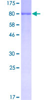 12.5% SDS-PAGE Stained with Coomassie Blue.